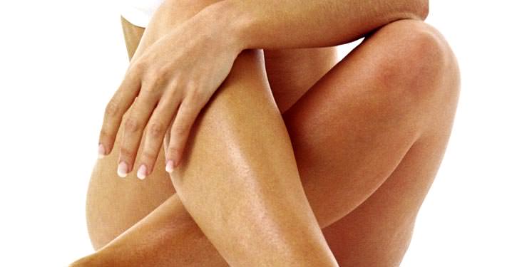 varicose veins in wome varicose veins in wome